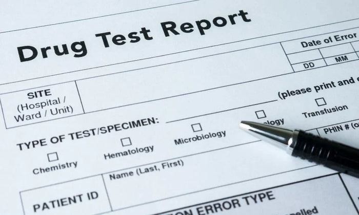 The Advantages of Hair Follicle Drug Testing