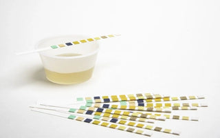 Common Errors in Urinalysis Testing: What You Should Know
