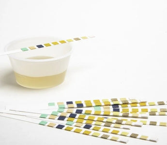 Common Errors in Urinalysis Testing: What You Should Know