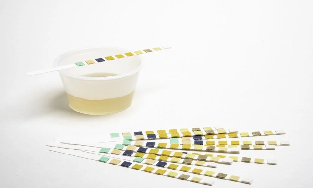Common Errors in Urinalysis Testing: What You Should Know