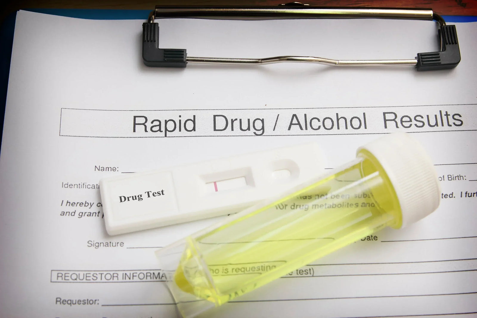 Everything About Home Drug Testing for Teens