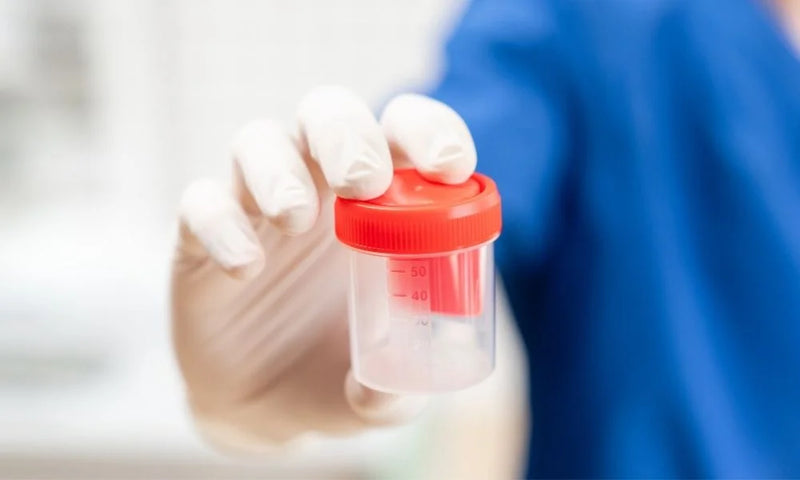 Instant Drug Test Cups vs Lab-Based Testing: Which to Buy