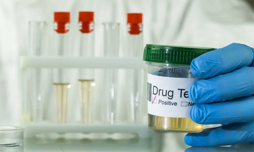 How To Implement Drug Testing in the Workplace