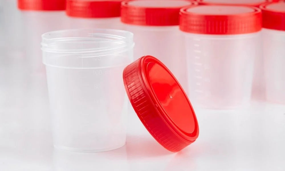 How To Properly Conduct Random Drug Testing