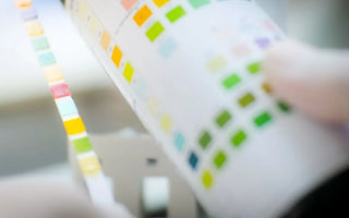 How To Read Urinalysis Test Strips