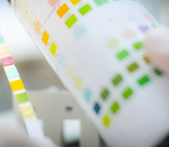 How To Read Urinalysis Test Strips