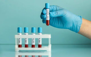 Important Things to Consider When Choosing Blood Collection Tubes