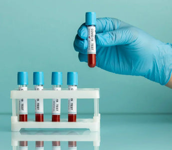 Important Things to Consider When Choosing Blood Collection Tubes