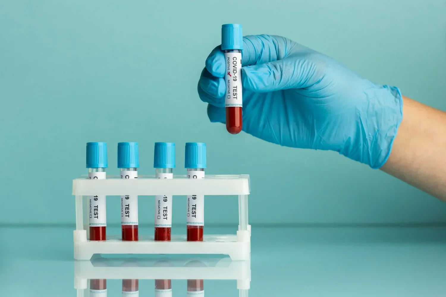 Important Things to Consider When Choosing Blood Collection Tubes
