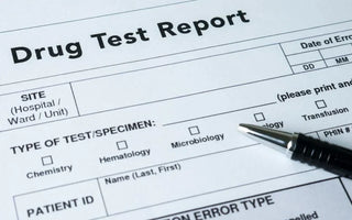 The Advantages of Hair Follicle Drug Testing