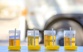 The Difference Between Drug Testing and Drug Screening