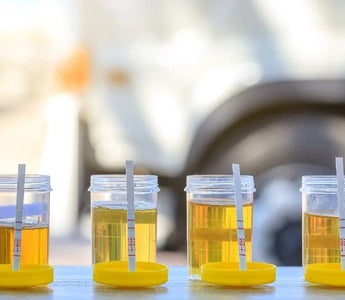 The Difference Between Drug Testing and Drug Screening