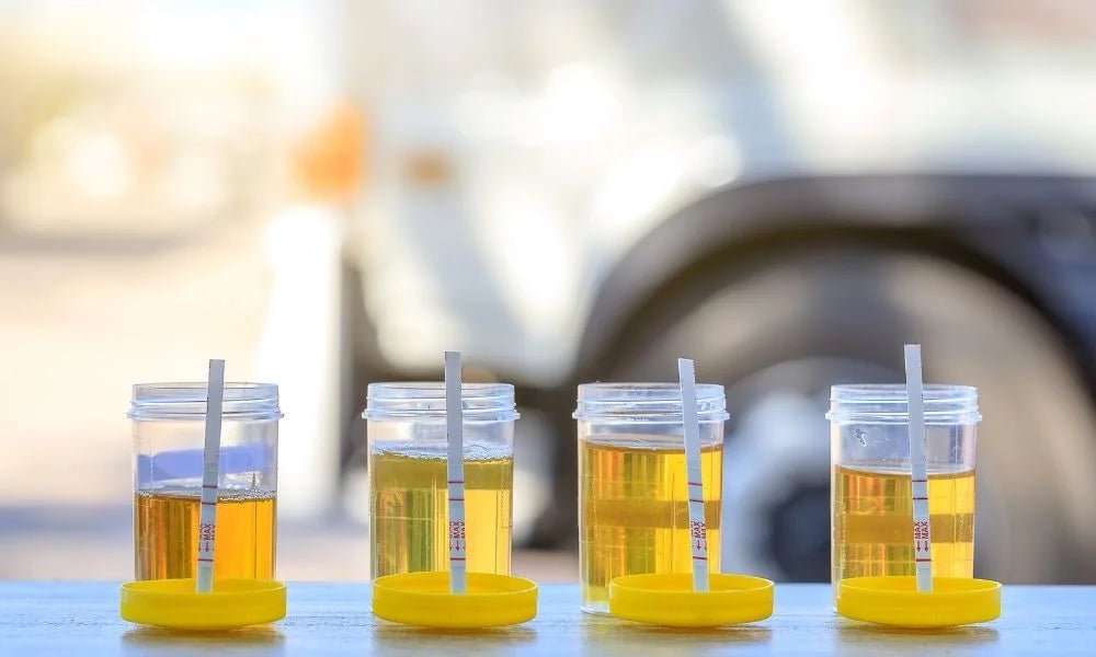 The Difference Between Drug Testing and Drug Screening