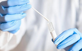 The Difference Between Urine and Saliva Drug Testing