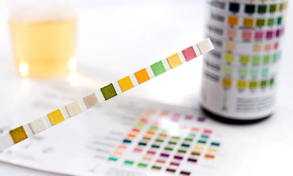 The Different Drug Abbreviations in Drug Testing