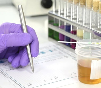 Understanding Benzodiazepine Urine Drug Screen Results