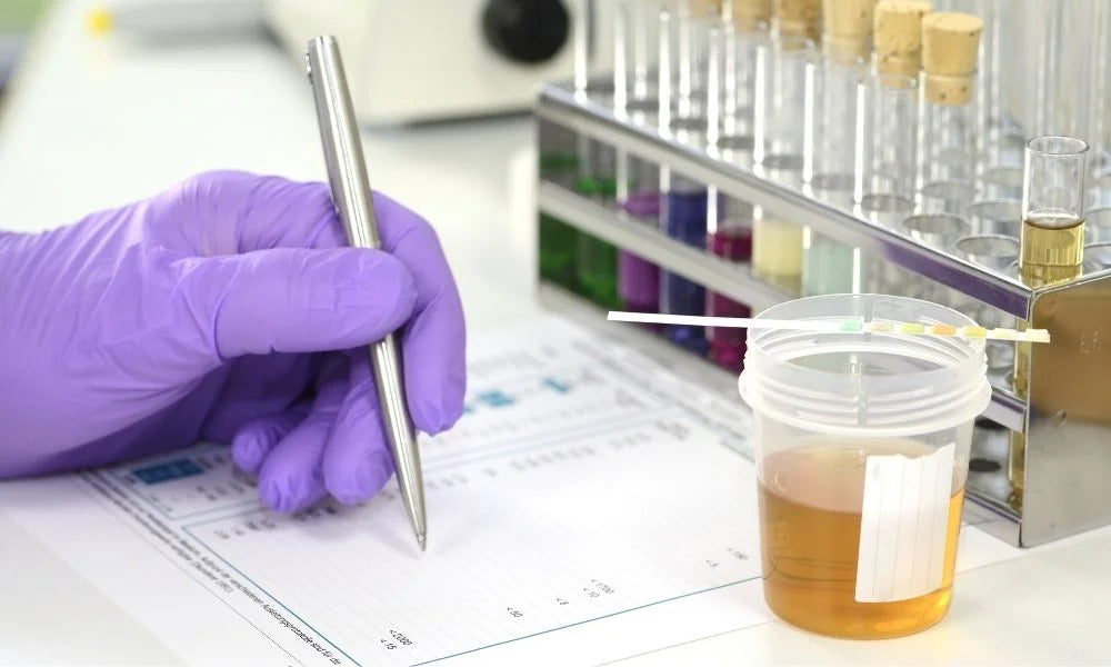 Understanding Benzodiazepine Urine Drug Screen Results