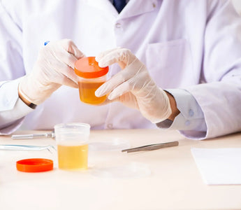 Ways Your Teen Can Cheat Their Drug Test