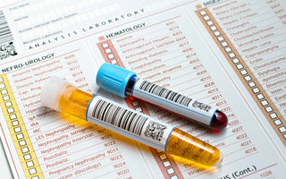 What Are The 5 Common Ways To Test For Drugs And Alcohol?
