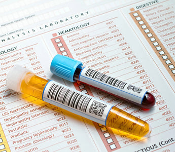 What Are The 5 Common Ways To Test For Drugs And Alcohol?