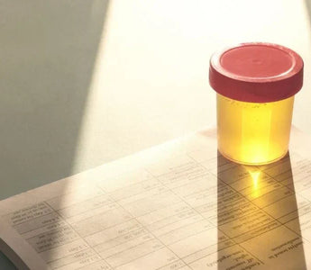 What Can Cause Invalid Drug Test Results