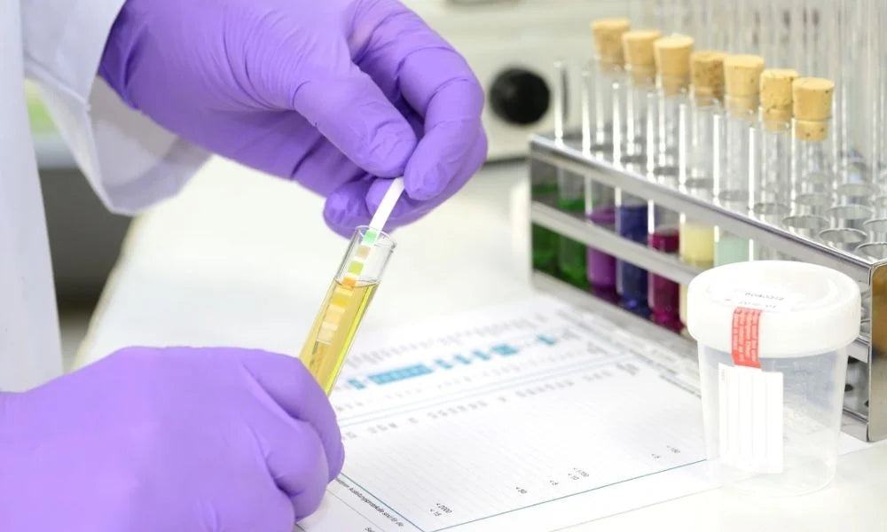 What Is a Regulated Drug Screen?