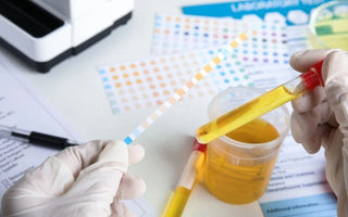 What Oxidant Activity Means on a Drug Test