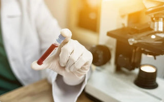 What You Should Know about Blood Drug Testing