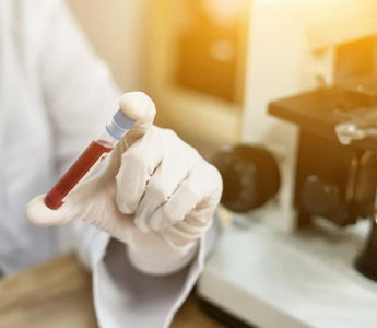 What You Should Know about Blood Drug Testing