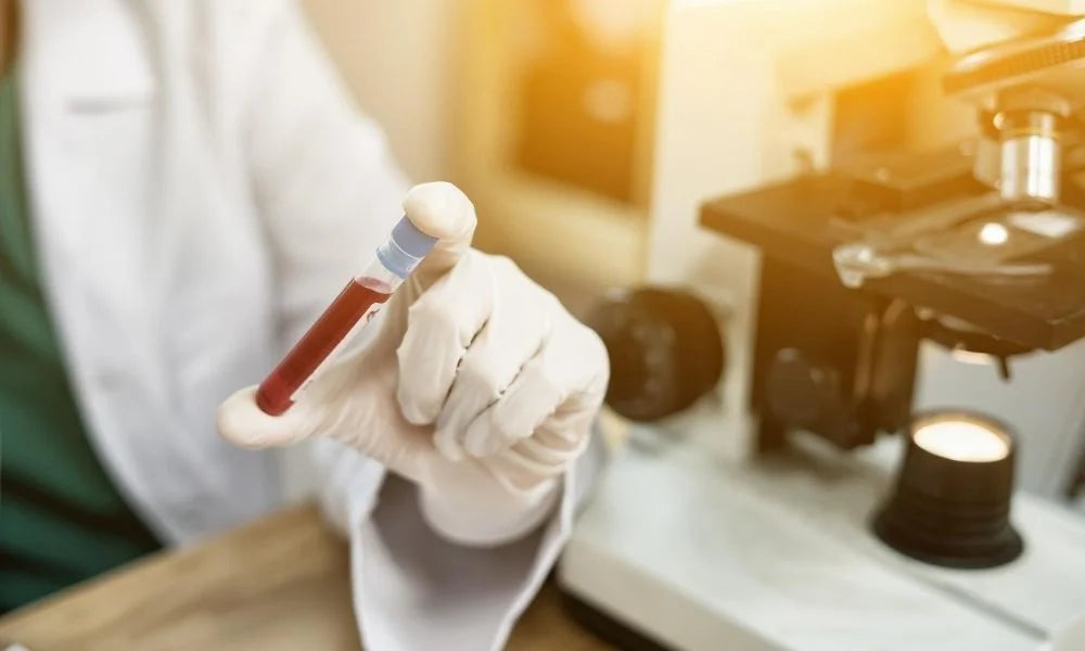 What You Should Know about Blood Drug Testing
