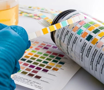 What a 5-Panel Drug Test Tests For