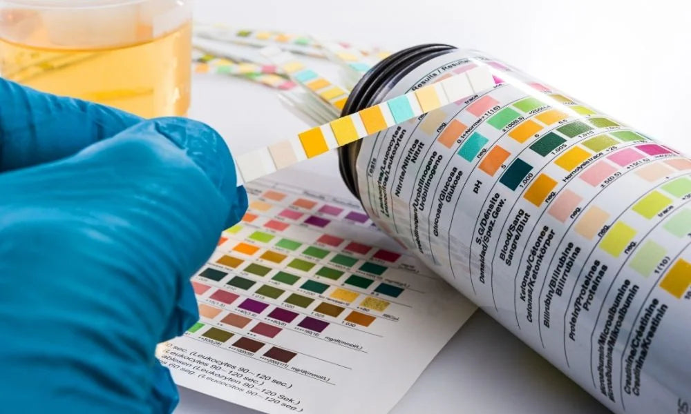 What a 5-Panel Drug Test Tests For