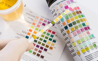 What do the Colors Mean on a Drug Test Cup