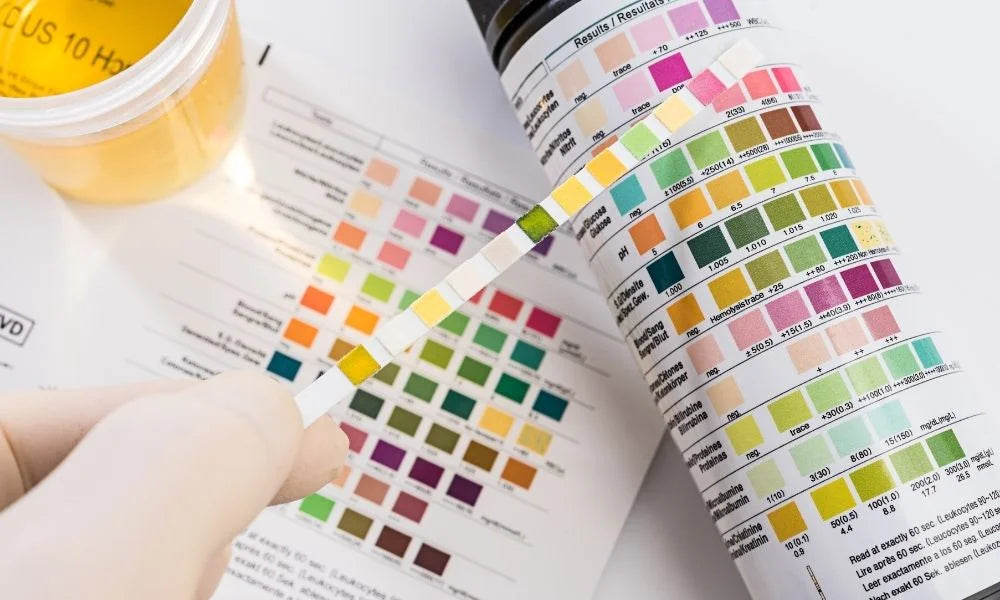 What do the Colors Mean on a Drug Test Cup