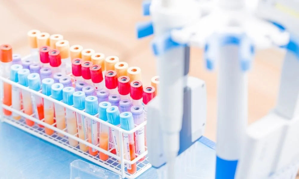 Which Vacutainer Tubes To Use for What Tests